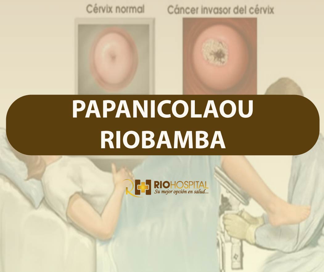 papanicolau riobamba